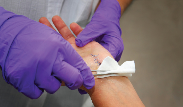 Minor Surgeries and Wound Care