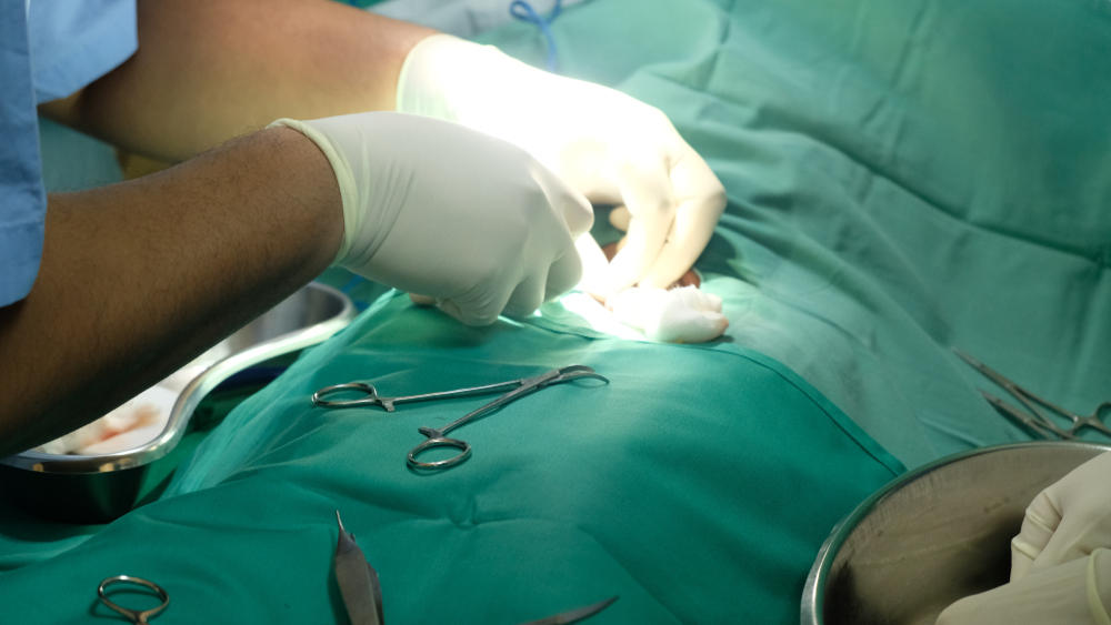 Medical Male Circumcision